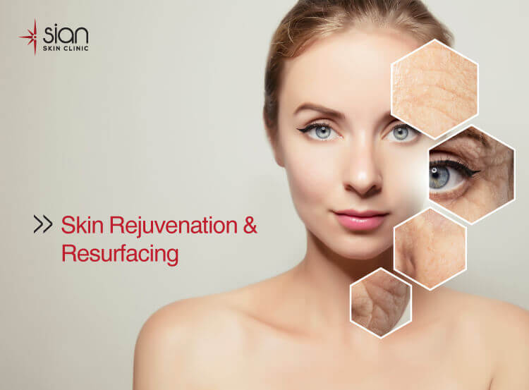 Skin Rejuvenation Treatment