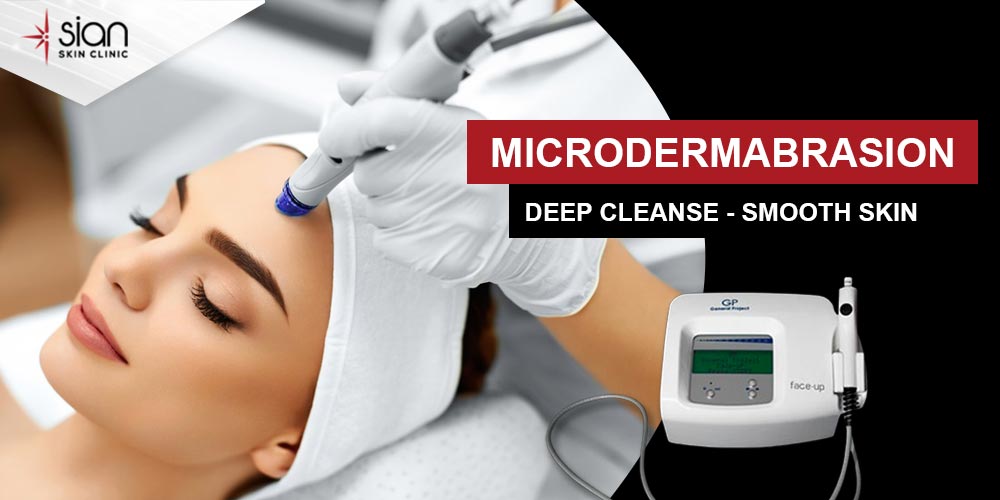 Microdermabrasion in HCMC: Benefits, Cost and What to Expect - SIAN