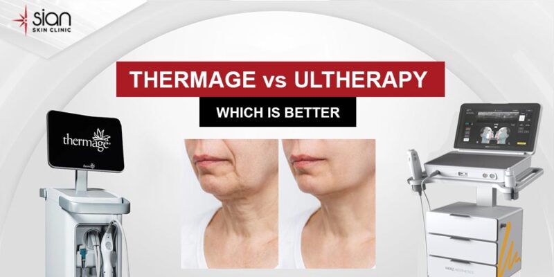 Thermage vs Ultherapy: What is the Difference? - SIAN Skin Clinic