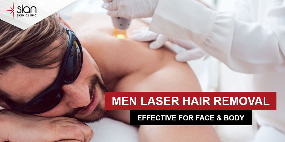 Men laser hair removal at SIAN Clinic (Private Clinic in Ho Chi Minh City)