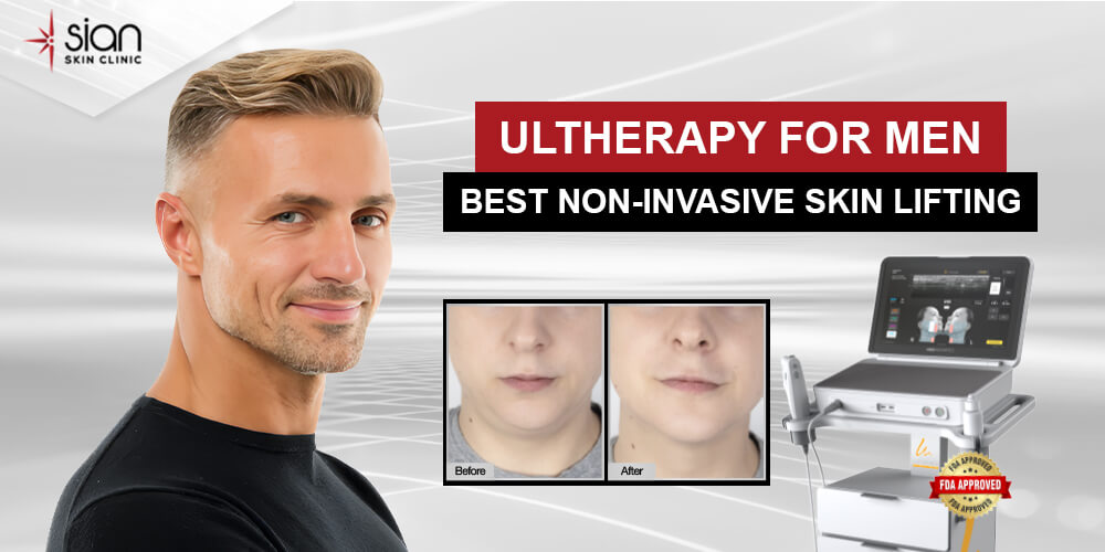 Ultherapy for Men: The Most Effective and Popular Skin-Lifting Treatment