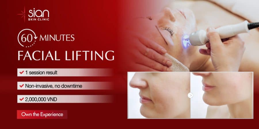 facial-lifting-popup