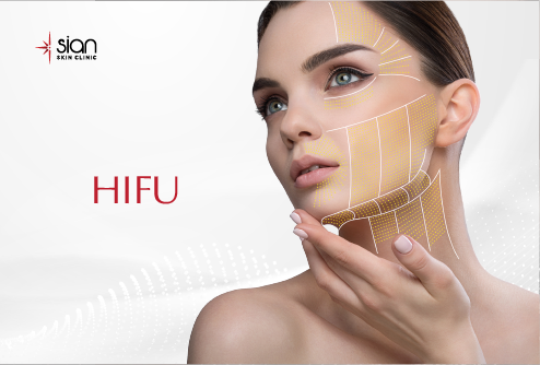 hifu-vietnam-at-sian-skincare-clinic