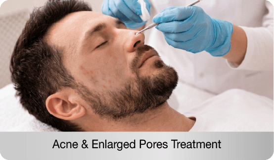 acne-and-enlarged-pores-treatment-controls-breakouts-refines-pores-and-improves-overall-skin-clarity