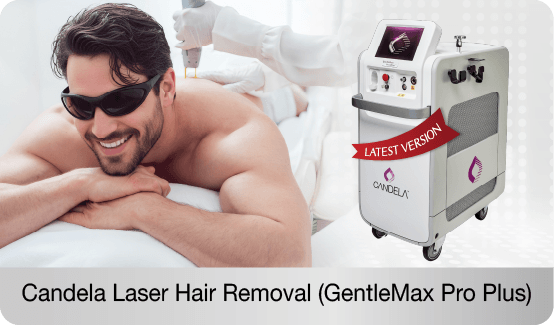candela-laser-hair-removal-gentlemax-pro-plus-removes-unwanted-hair-minimizes-ingrown-hairs-and-works-safely-on-all-skin-types