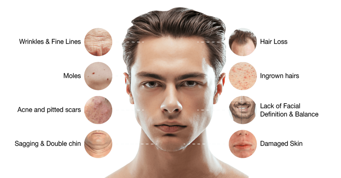 common-skin-appearance-concerns-for-men