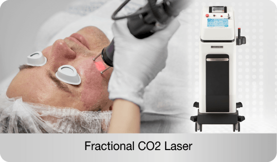 fractional-co2-laser-improves-skin-texture-reduces-pitted-acne-scars-and-repairs-damaged-skin