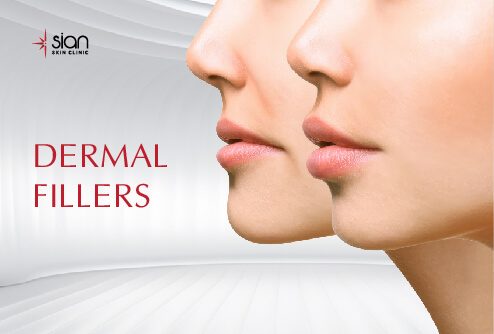 dermal-fillers-treatment-in-vietnam